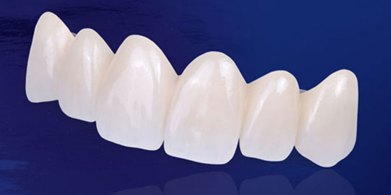 Bọc răng sứ cho răng sâu có đau không