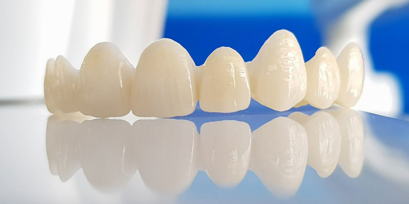 Các phương pháp trồng răng phổ biến