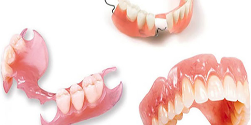 Nên làm răng giả tháo lắp hay cố định