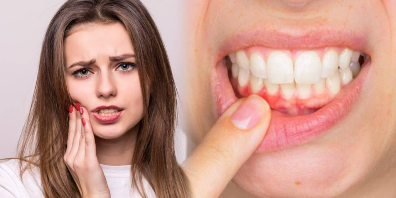 Nguyên nhân bị chảy máu chân răng