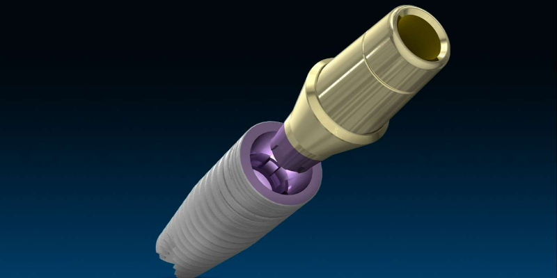 Vai trò của trụ Implant
