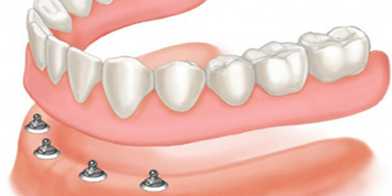 Ưu nhược điểm của phương pháp 