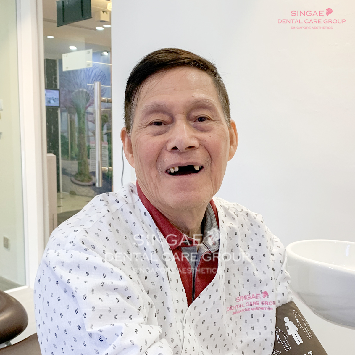 Review nha khoa Singae có tốt hay không, chất lượng ra sao? 14 Trồng Implant tại Nha khoa Singae