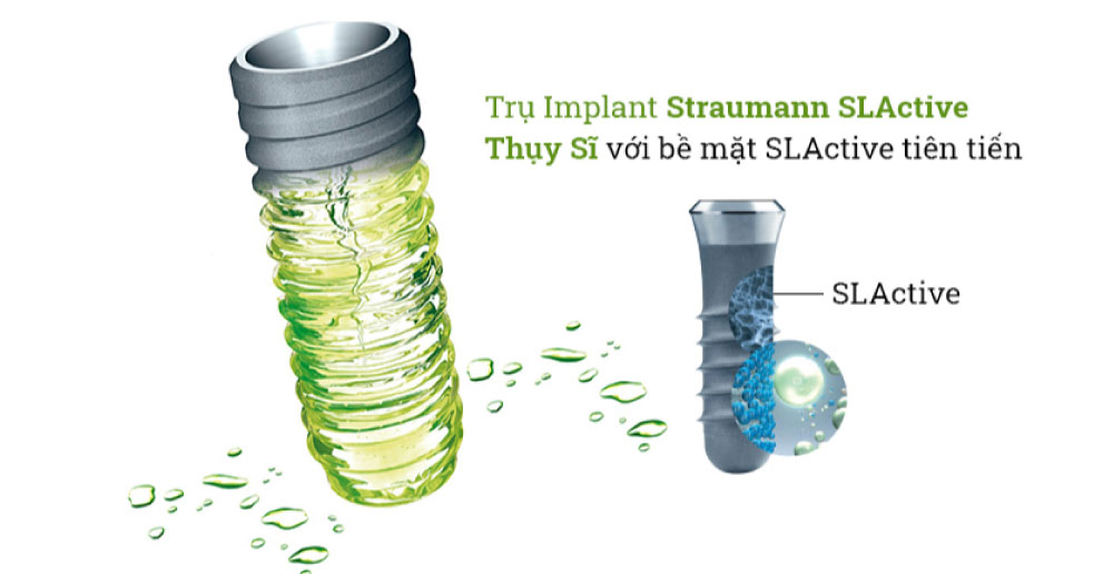 Implant Straumann (Thụy sĩ) thuộc phân khúc cao cấp