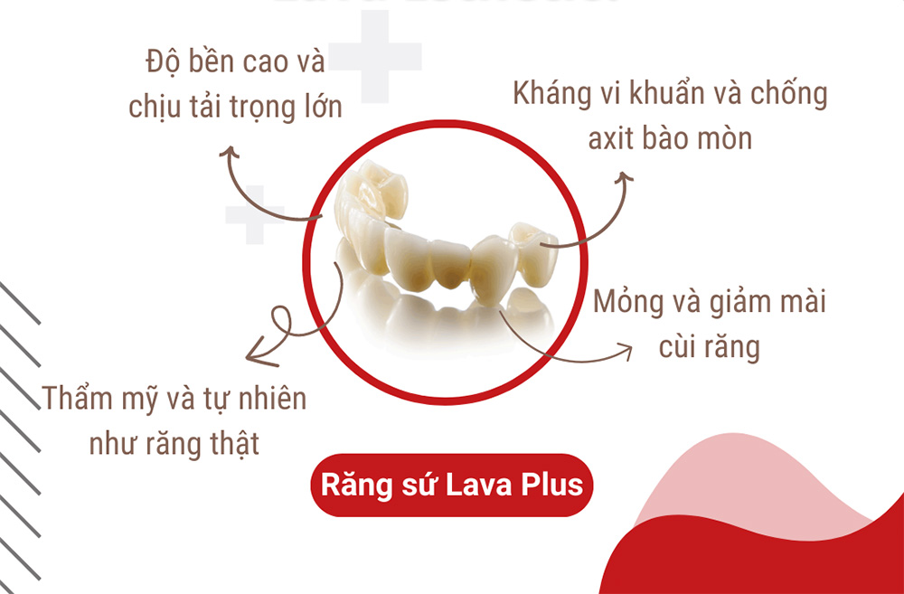 chi phí trồng răng implant