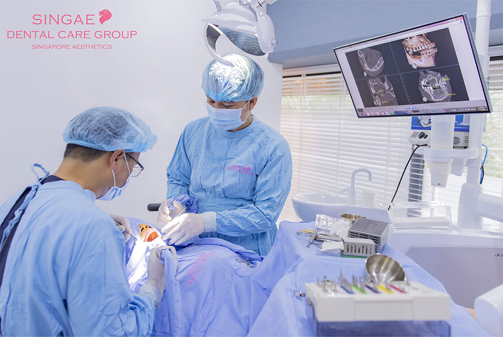 chi phí trồng răng implant