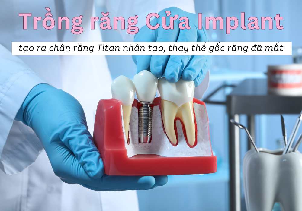 Trồng răng cửa bị gãy