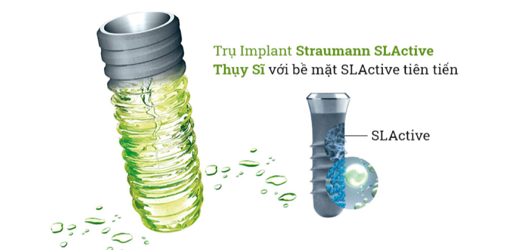 Trồng răng implant giá rẻ nhất là mấy 1 trụ? Chớ ham rẻ! 15 cấy ghép implant giá rẻ