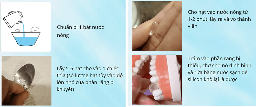 Răng giả Silicon