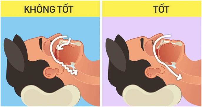 Các sai lầm phổ biến khi thực hiện Mewing