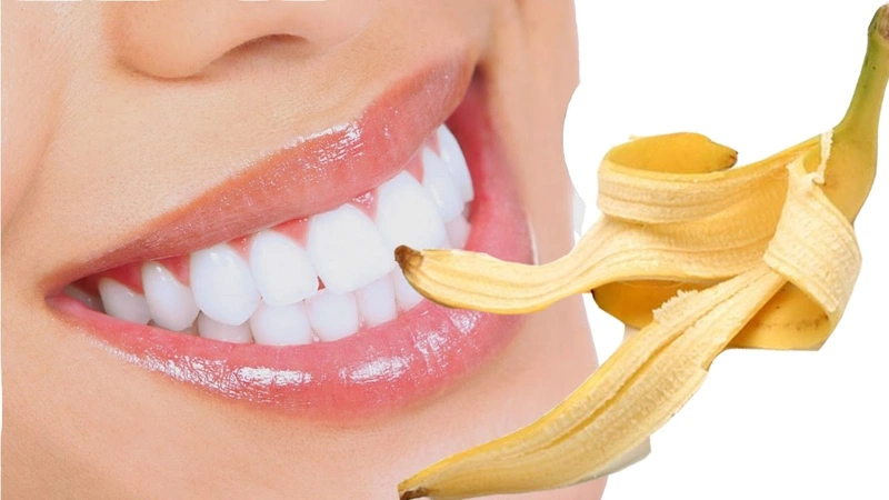 9 Mẹo lấy cao răng tại nhà hiệu quả, an toàn và lưu ý 13 Cách cạo vôi răng bằng vỏ chuối
