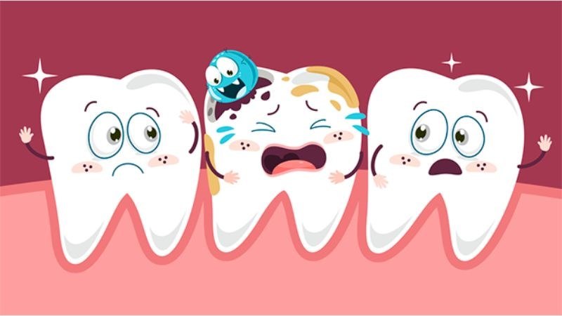 Cách điều trị sâu chân răng phổ biến hiện nay