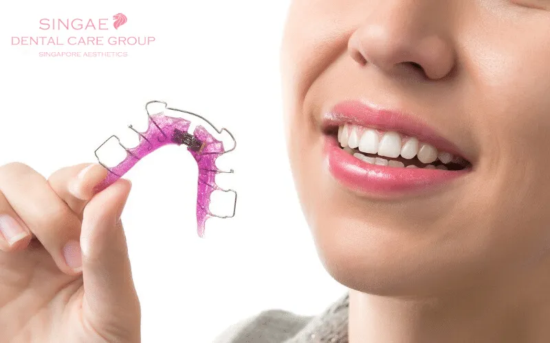 Hướng dẫn đeo hàm duy trì Hawley