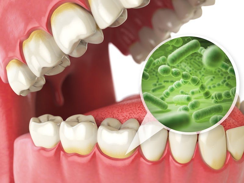 Nguyên nhân trẻ 7 tuổi bị sâu răng hàm