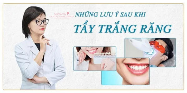 Những lưu ý sau khi tẩy trắng răng