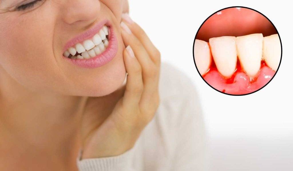 triệu chứng của bệnh sâu răng