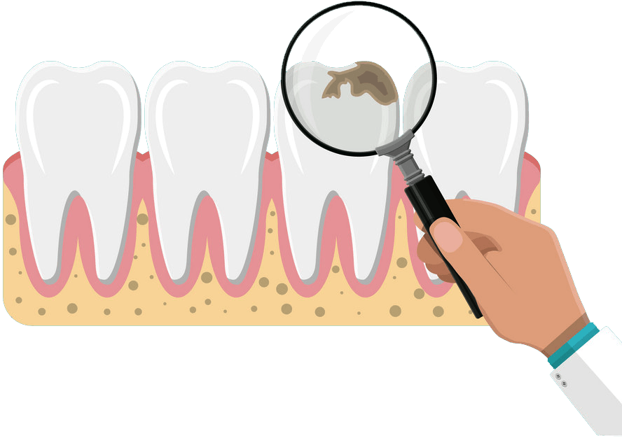 Phương pháp chẩn đoán sâu răng