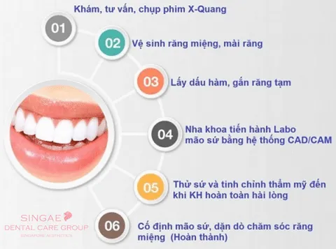 Quy trình bọc răng sứ
