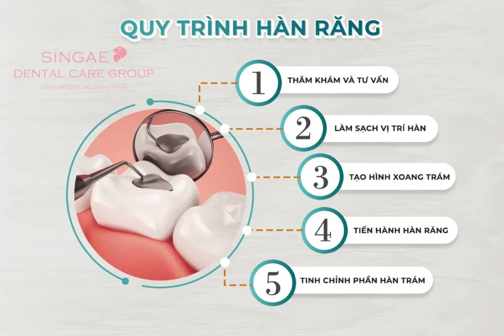 Quy trình hàn răng