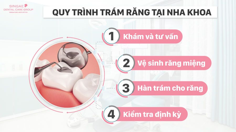 Quy trình hàn răng sâu