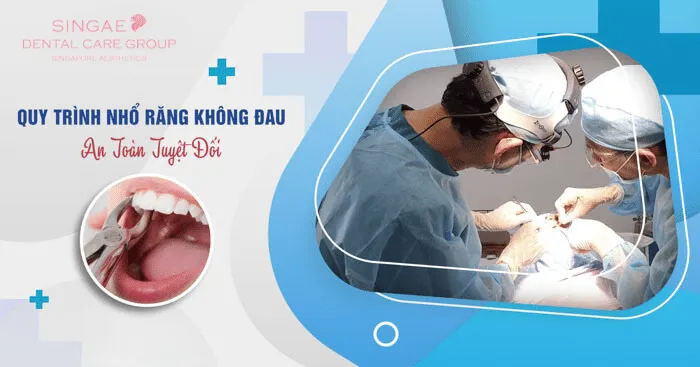Quy trình nhổ răng