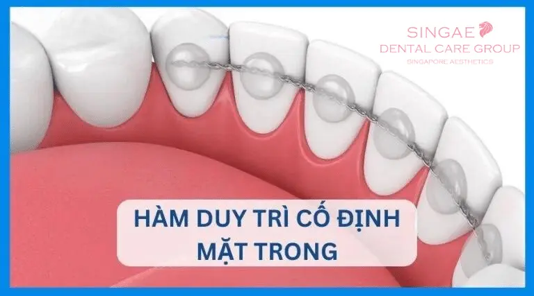 Hàm duy trì là gì? Có mấy loại? 5 điều bạn nên biết ! 9 Hàm duy trì cố định