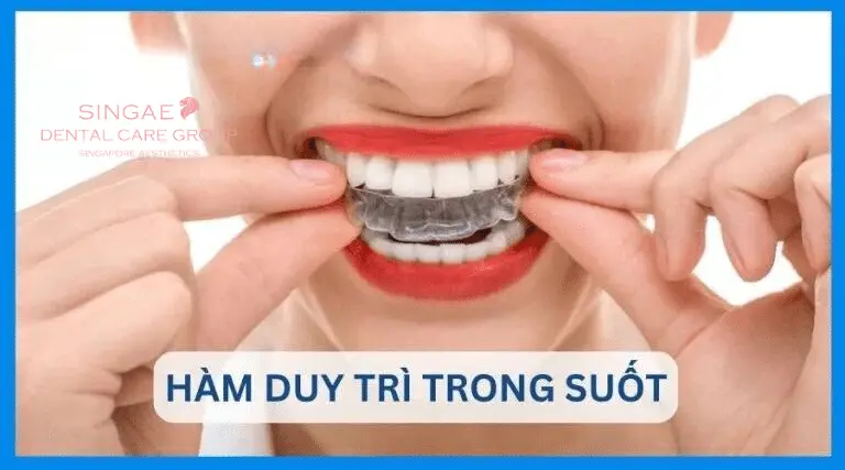 Hàm duy trì là gì? Có mấy loại? 5 điều bạn nên biết ! 8 hàm duy trì trong suốt