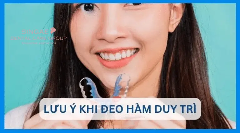 Hàm duy trì là gì? Có mấy loại? 5 điều bạn nên biết ! 10 Lưu ý khi đeo hàm duy trì