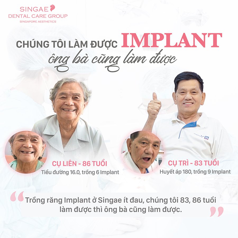Trồng răng Implant là gì? Ưu nhược điểm, quy trình, chi phí