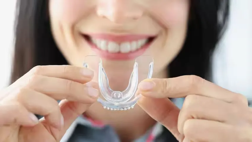 Cách sử dụng máng chống nghiến răng