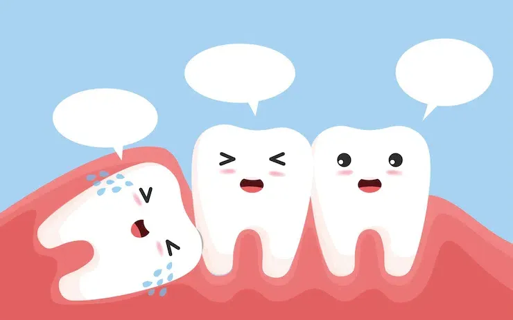 Nhổ răng khôn có nguy hiểm không? 9 biến chứng và lưu ý 8 Khi nào nên và không nên nhổ răng khôn
