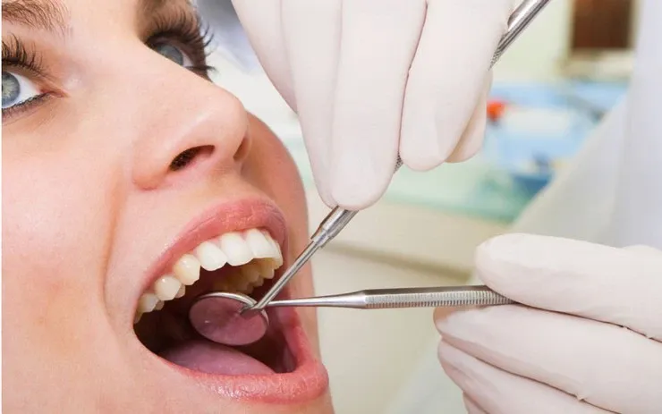 Lưu ý sau khi nhổ răng số 8