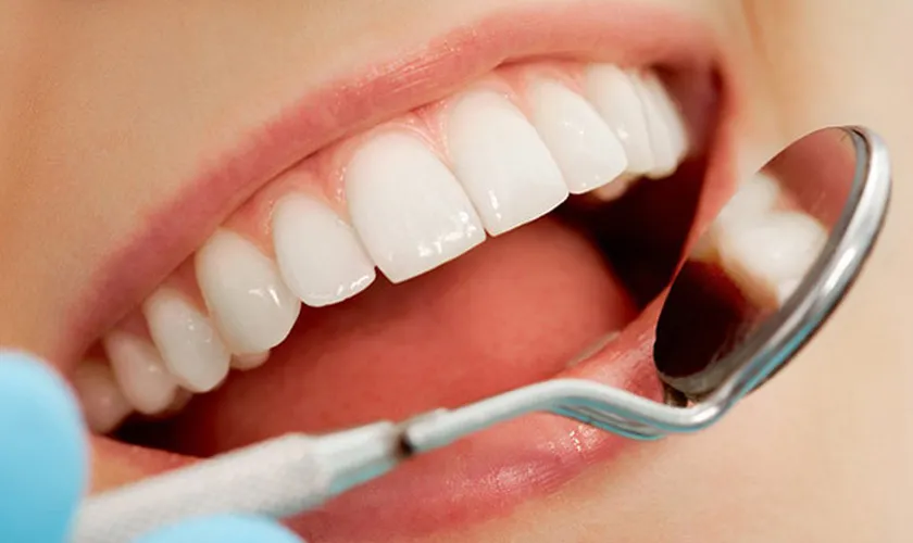 Răng sứ Bio Esthetic