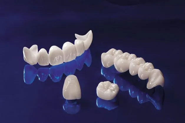 Răng sứ Cercon có tốt không? Giá bao nhiêu? Có mấy loại? 9 Răng sứ Cercon có mấy loại
