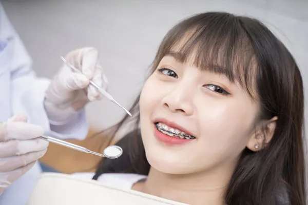 17 tuổi niềng răng bao nhiêu tiền