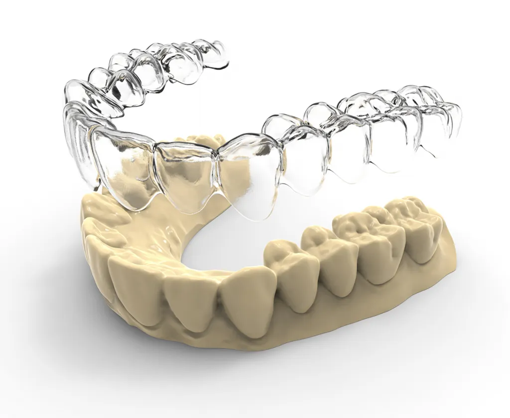 niềng răng trong suốt 3D Clear