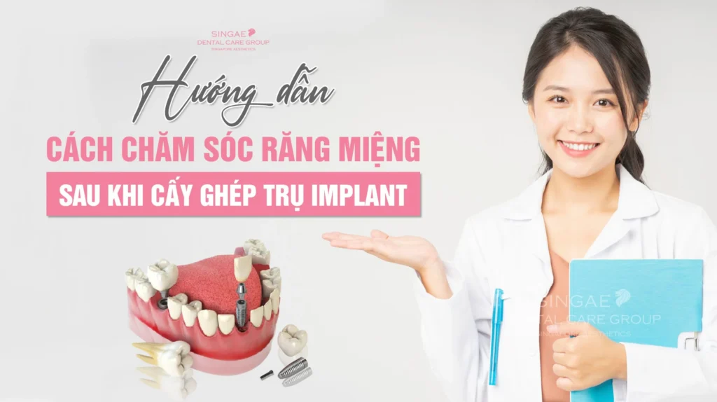 Giải đáp: Khi nào nên trồng răng Implant? 8 Cách chăm sóc răng Implant