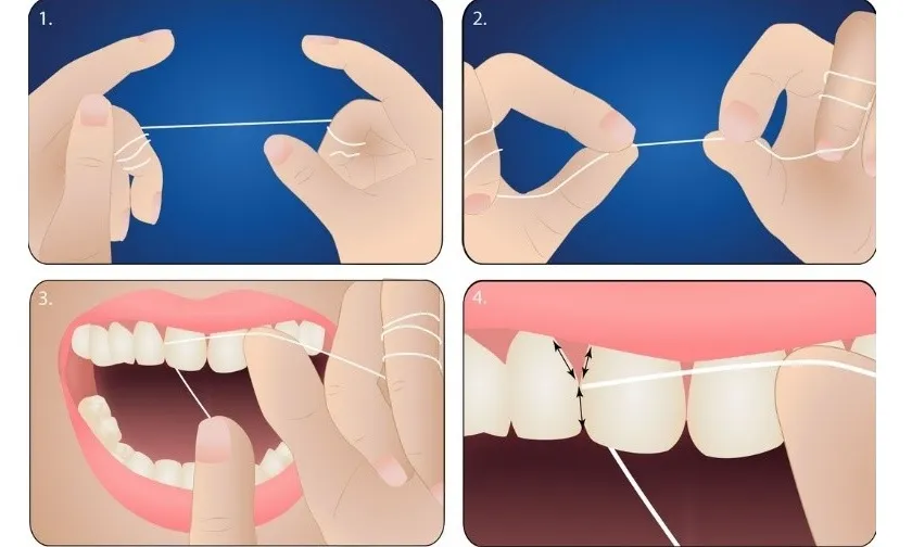 Hình ảnh viêm tủy răng giúp bạn sớm nhận biết và điều trị 10 Cách phòng ngừa viêm tủy răng