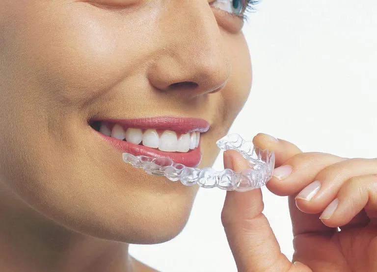 niềng răng trong suốt Clear Aligner