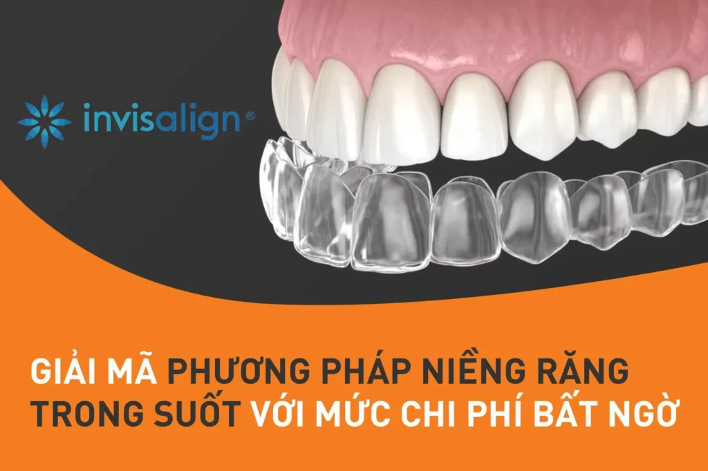 Niềng răng trong suốt Invisalign