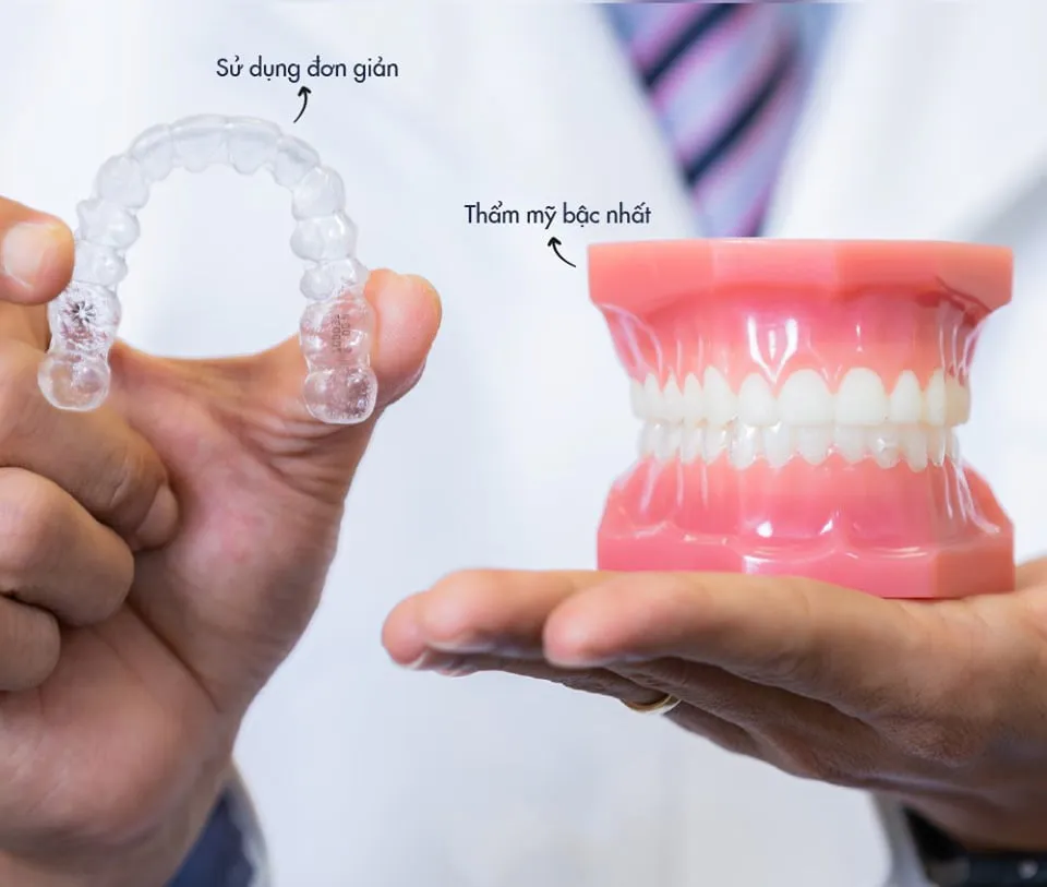 Niềng răng trong suốt giá bao nhiêu