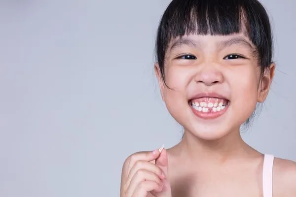 Thời gian niềng răng cho trẻ em