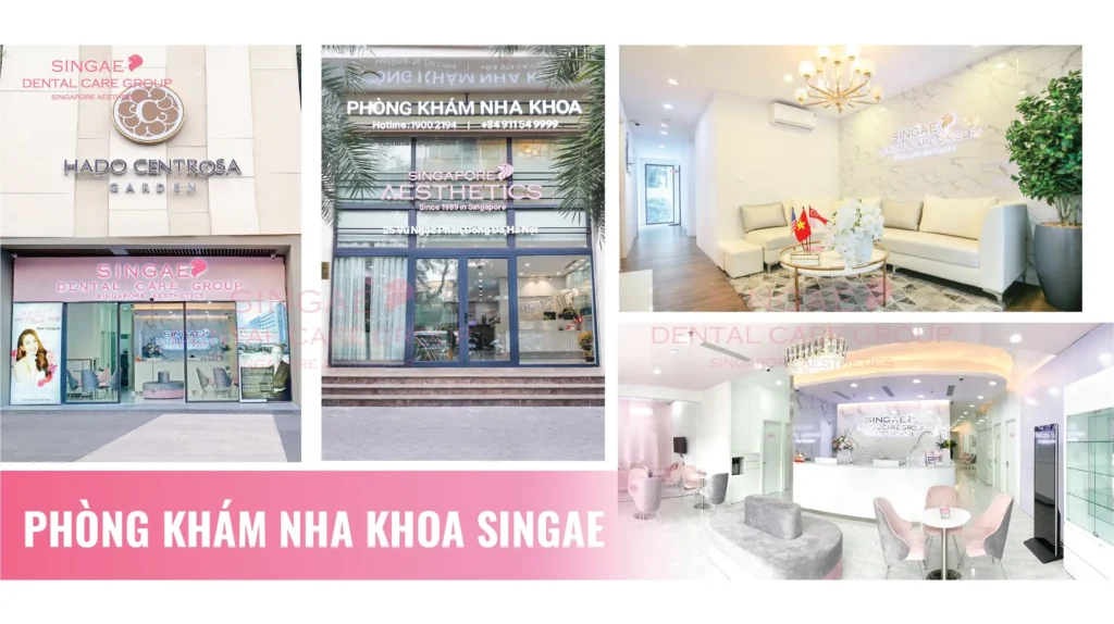 Bọc răng sứ có đau không? Có chảy máu, đau, ê buốt không? 8 Bọc răng sứ ở đâu không đau