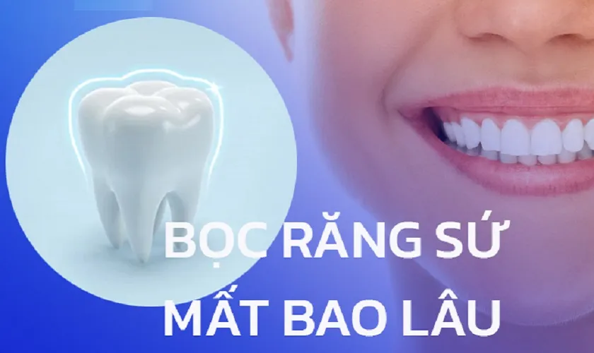 Bọc răng sứ thẩm mỹ mất bao lâu