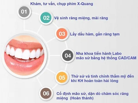 Quy trình bọc răng sứ thẩm mỹ