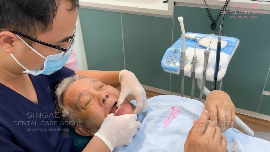 Quy trình cấy ghép Implant All on 4 tại Nha khoa Singae