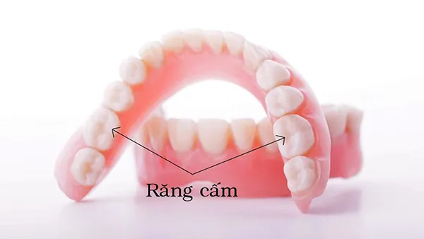 Răng cấm là gì? Răng cấm có thay không và cách vệ sinh đúng 4 Răng cấm là răng gì