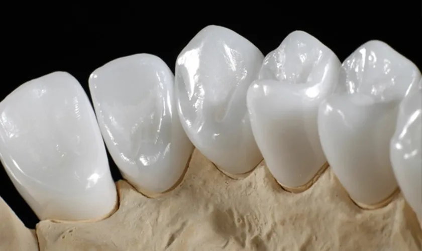 Răng sứ Zirconia giá bao nhiêu? 5 điều bạn nên biết