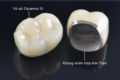 Thành phần và cấu tạo của răng sứ Zirconia