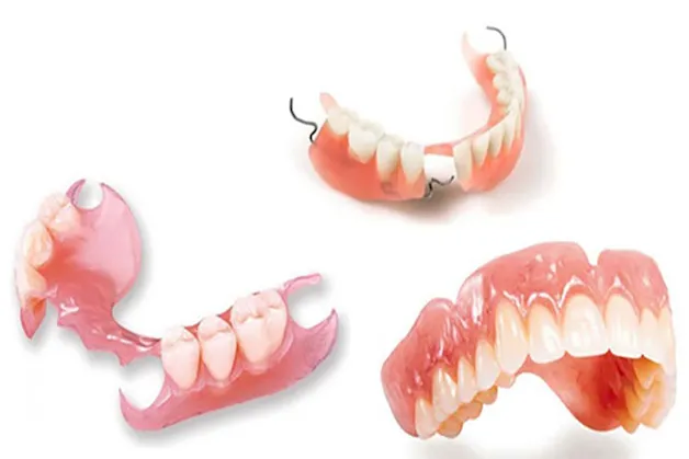 Trồng răng giả tháo lắp là gì? Có mấy loại, loại nào tốt?